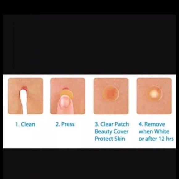 36 acne care/ Treatment/ pat ch - Picture 1 of 3